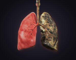 Lung health: Health-risks for men